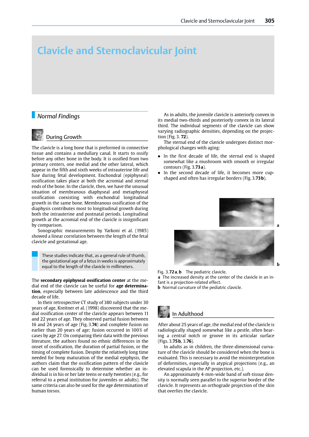 Clavicle and Sternoclavicular Joint 305