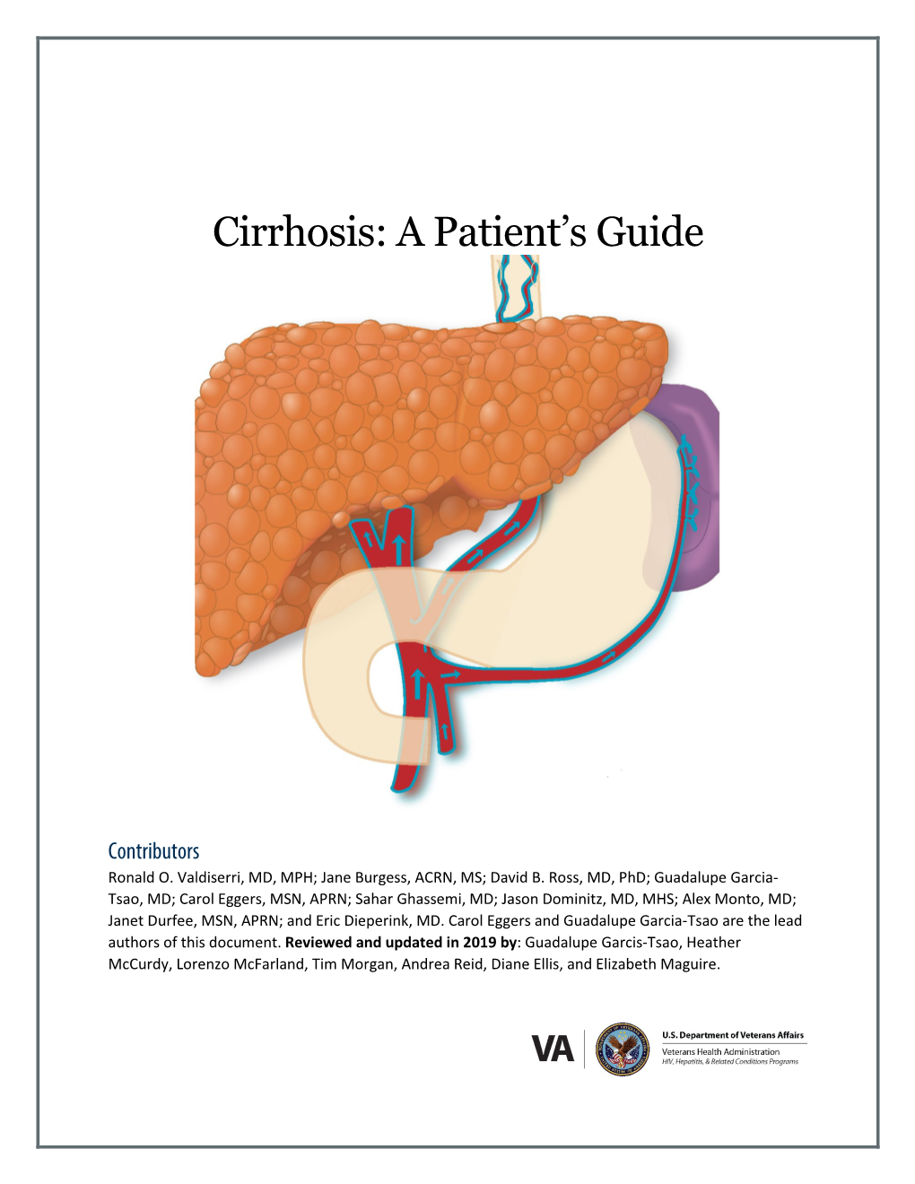 Cirrhosis a Patient Guide