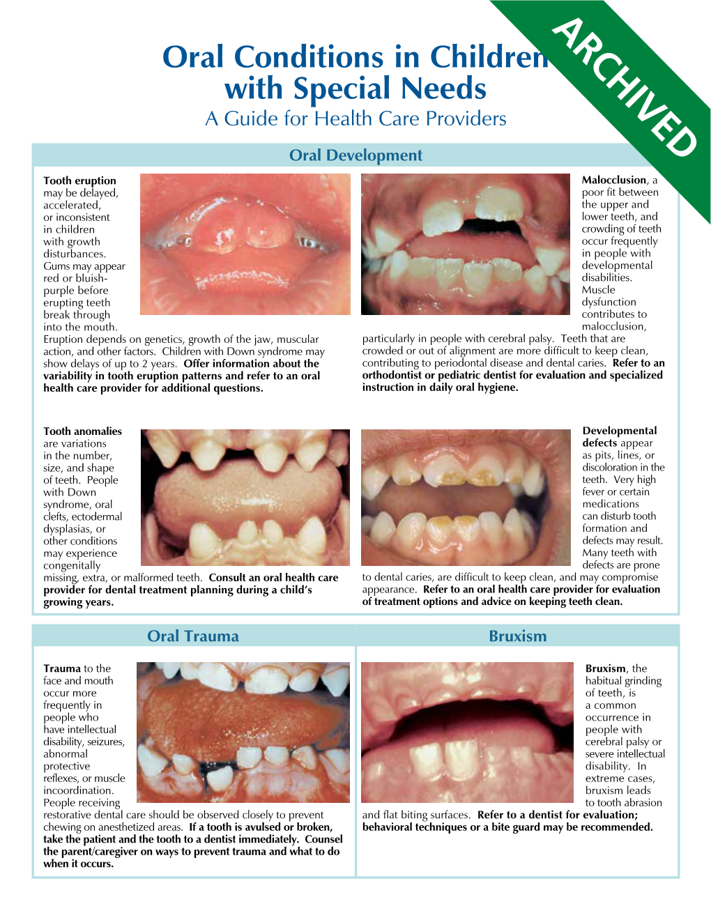 Oral Conditions in Children with Special Needs a Guide for Health Care Providers