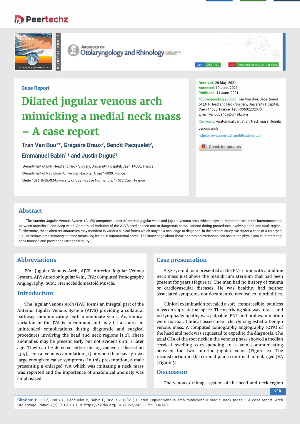 Dilated Jugular Venous Arch Mimicking a Medial Neck Mass – a Case Report