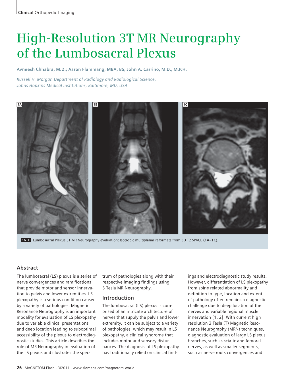 High-Resolution 3T MR Neurography of the Lumbosacral Plexus