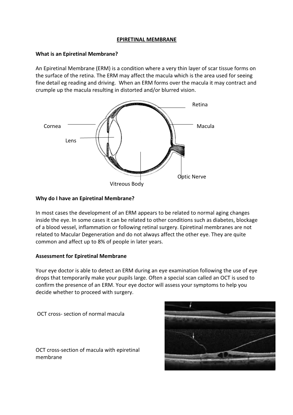 An Epiretinal Membrane (ERM) Is a Condition Where a Very Thin Layer of Scar Tissue Forms on the Surface of the Retina