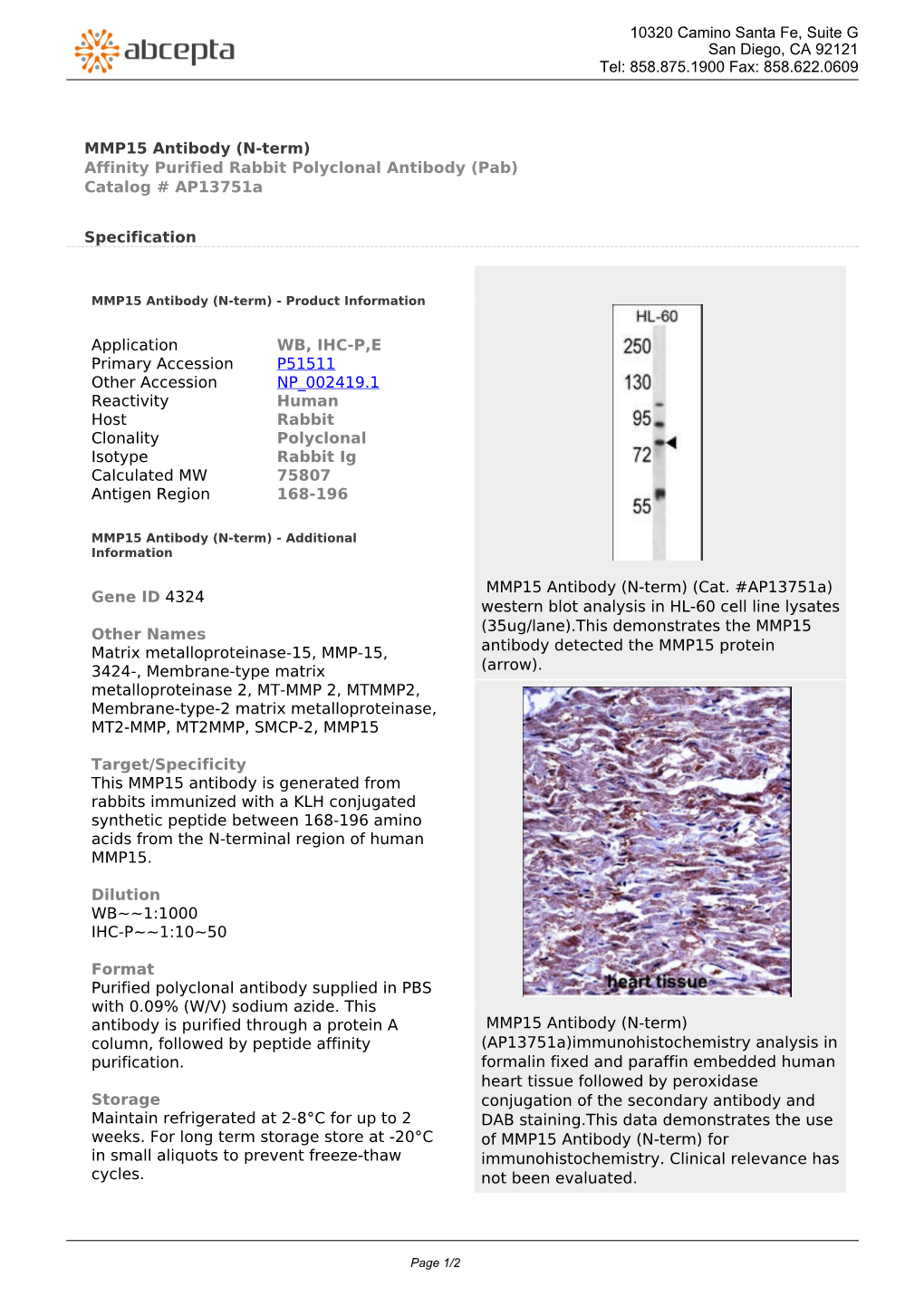 MMP15 Antibody (N-Term) Affinity Purified Rabbit Polyclonal Antibody (Pab) Catalog # Ap13751a