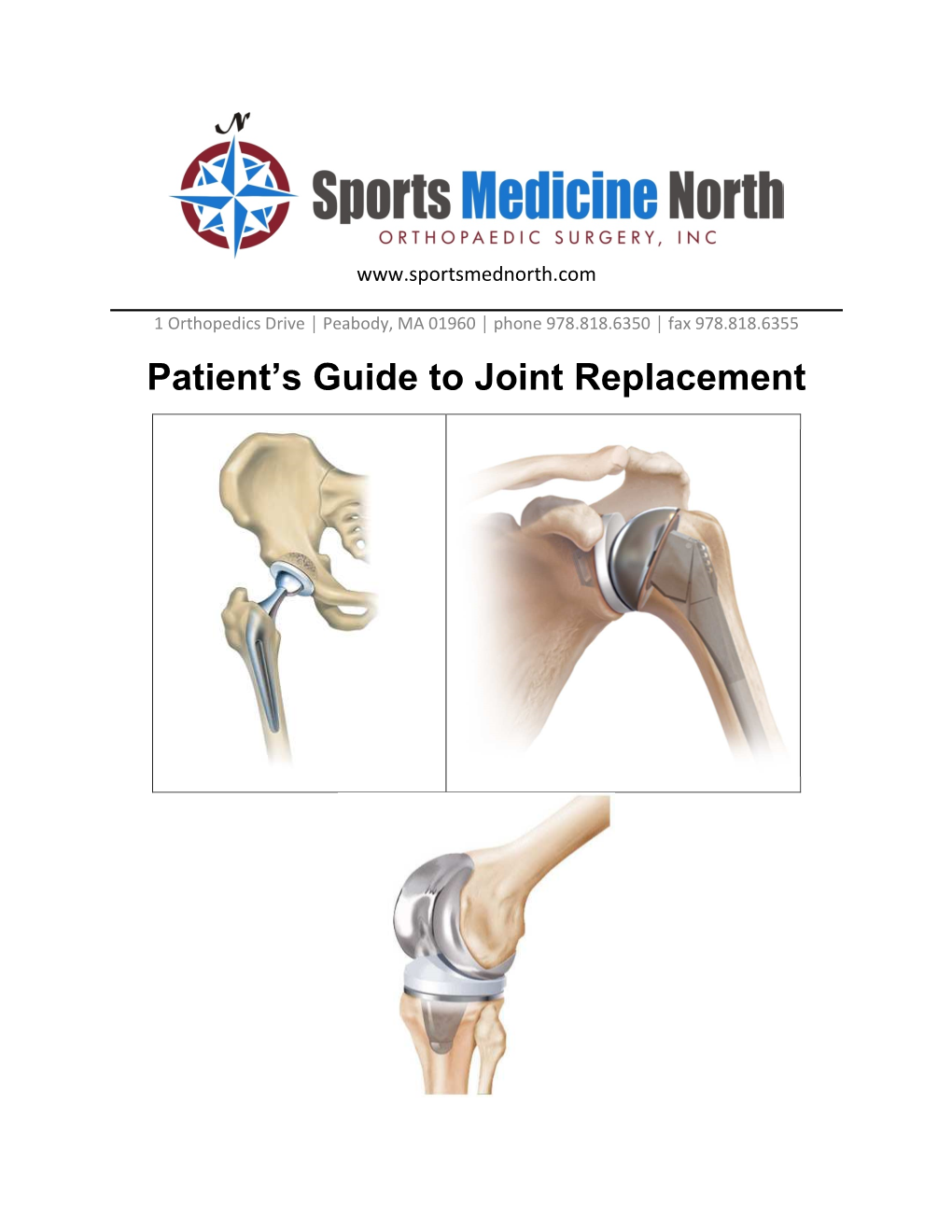 Patient's Guide to Joint Replacement
