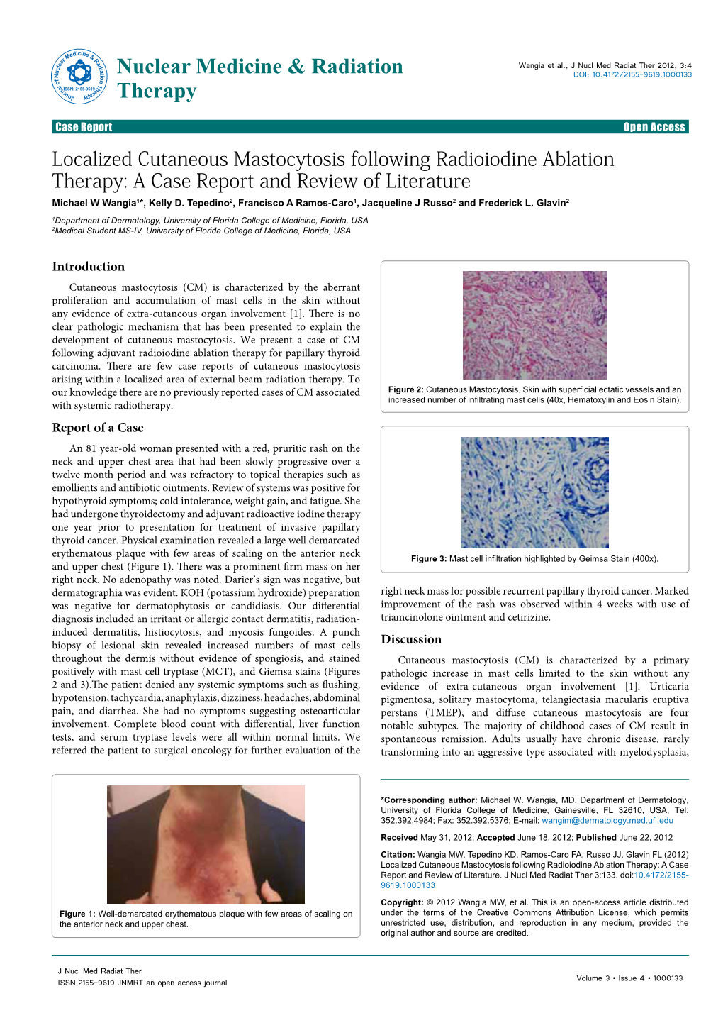 Localized Cutaneous Mastocytosis Following Radioiodine Ablation Therapy: a Case Report and Review of Literature Michael W Wangia1*, Kelly D