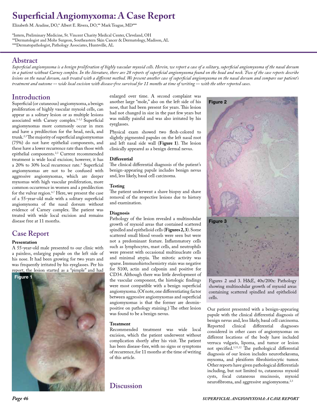 Superficial Angiomyxoma: a Case Report Elizabeth M