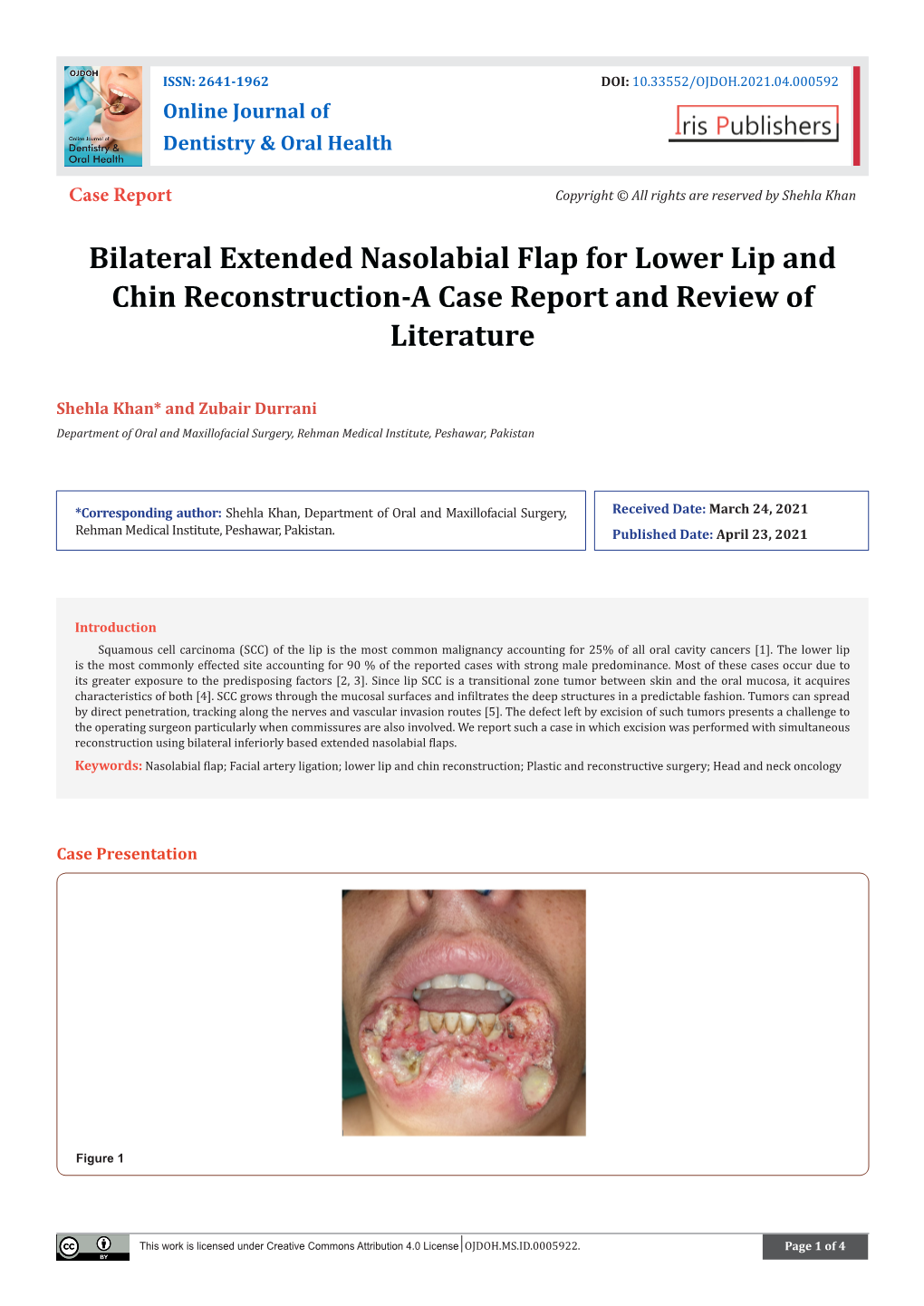 Bilateral Extended Nasolabial Flap for Lower Lip and Chin Reconstruction-A Case Report and Review of Literature