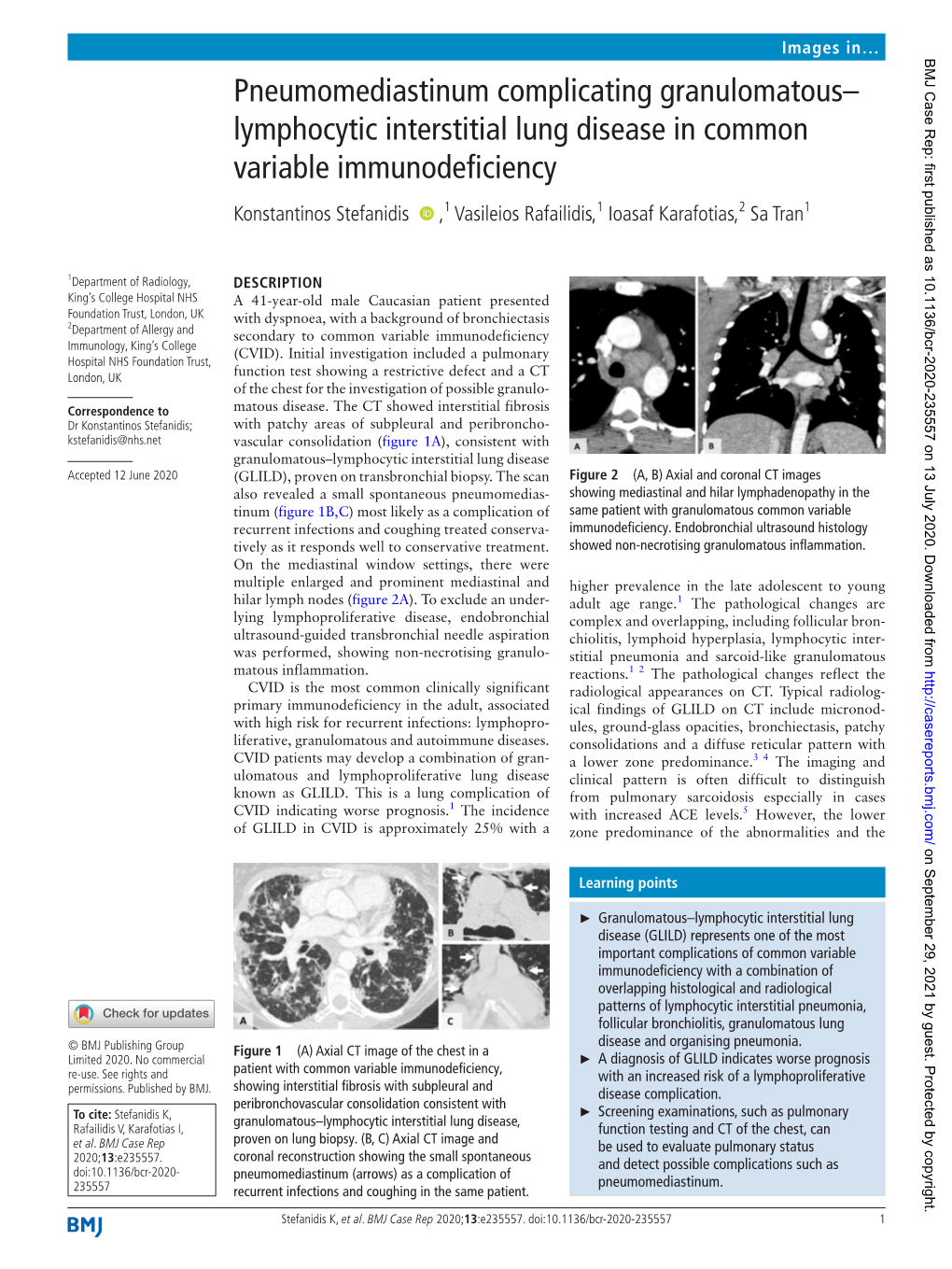 Pneumomediastinum Complicating Granulomatous–Lymphocytic