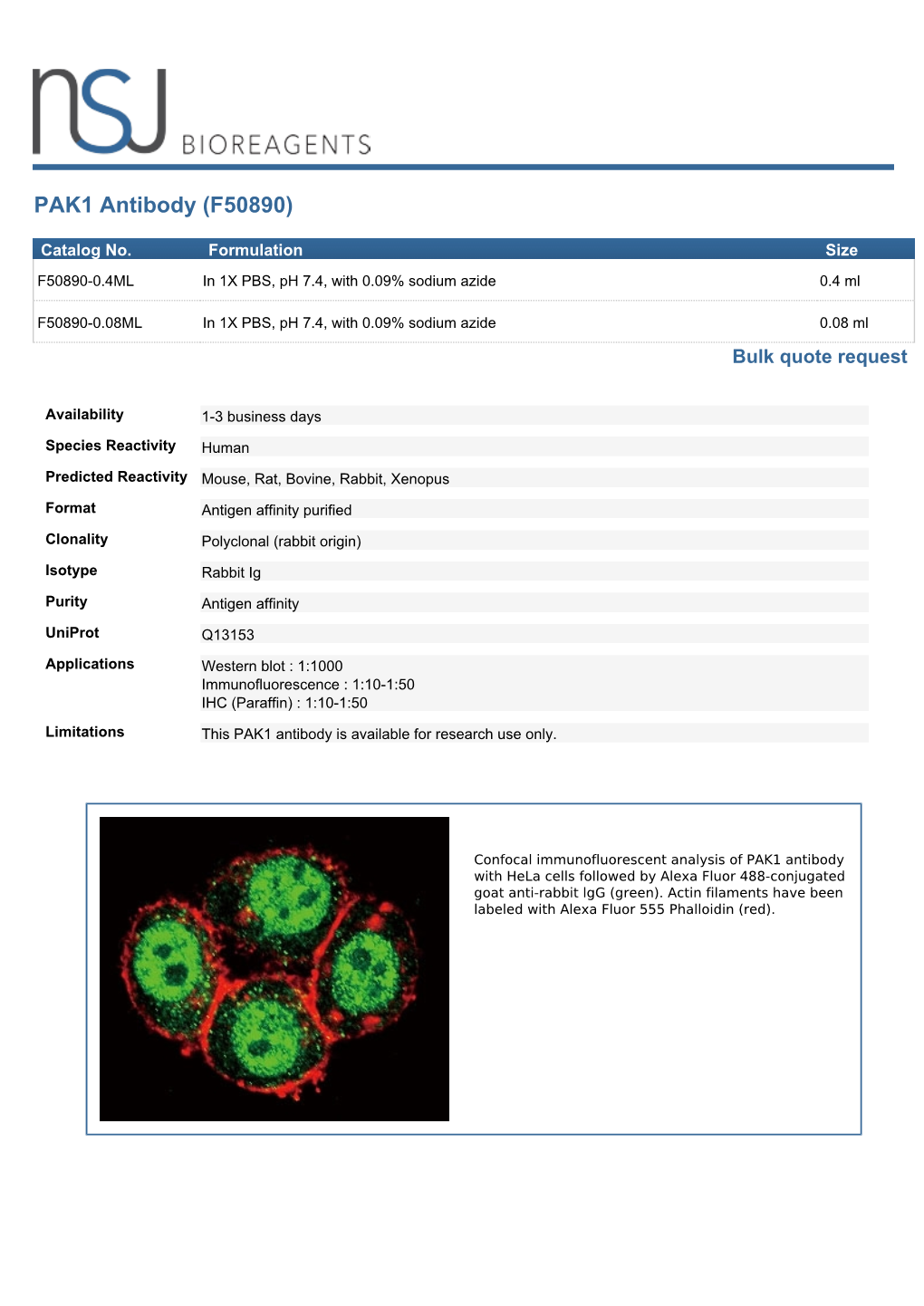 PAK1 Antibody (F50890)