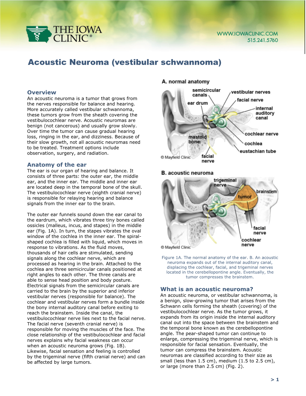 Acoustic Neuroma (Vestibular Schwannoma)