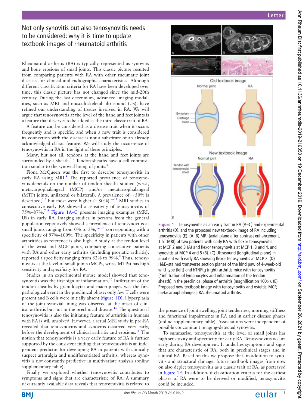 Not Only Synovitis but Also Tenosynovitis Needs to Be Considered: Why It Is Time to Update Textbook Images of Rheumatoid Arthritis