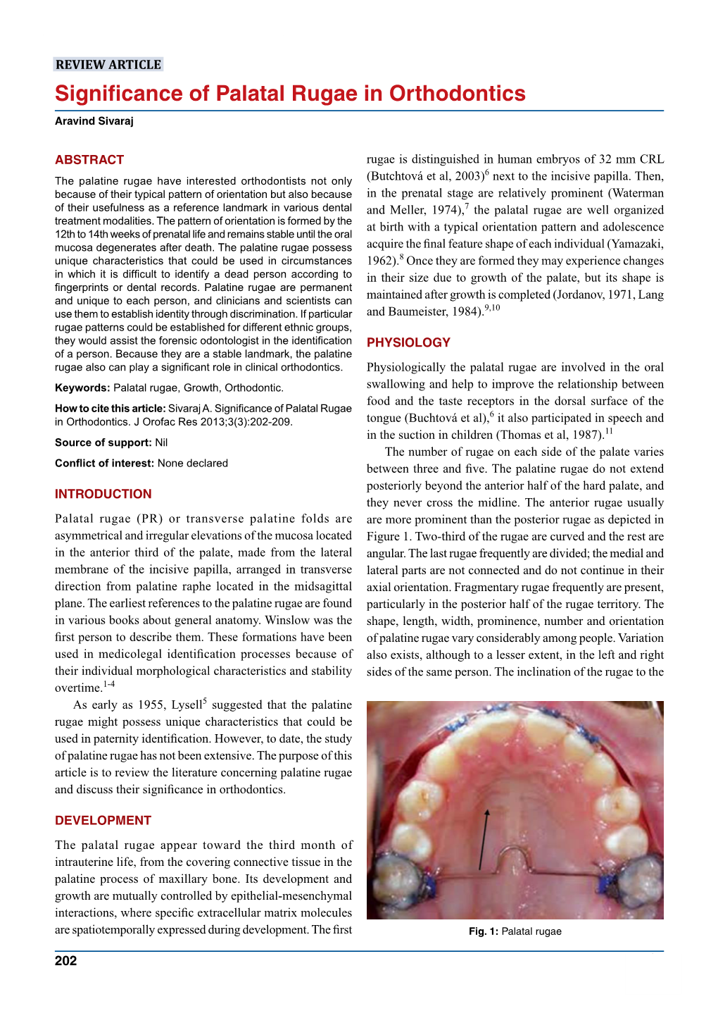 Significance of Palatal Rugae in Orthodontics Aravind Sivaraj