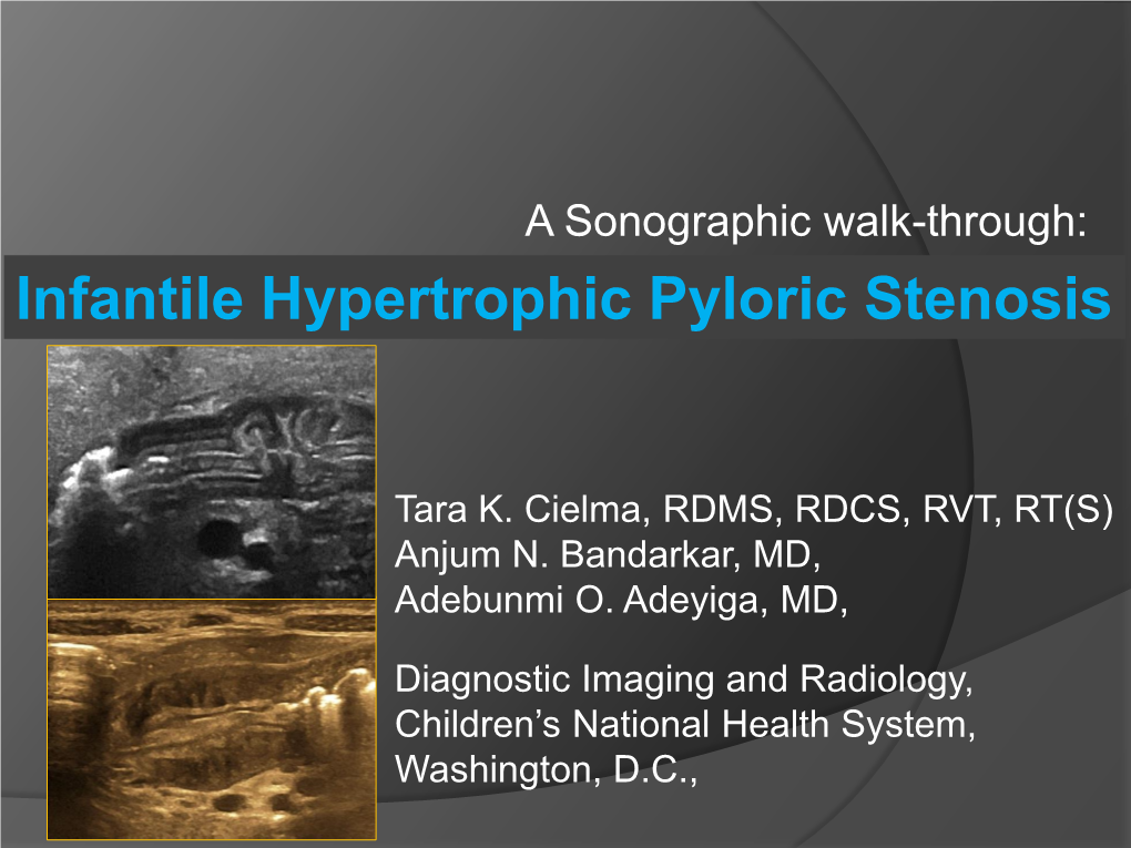 Infantile Hypertrophic Pyloric Stenosis