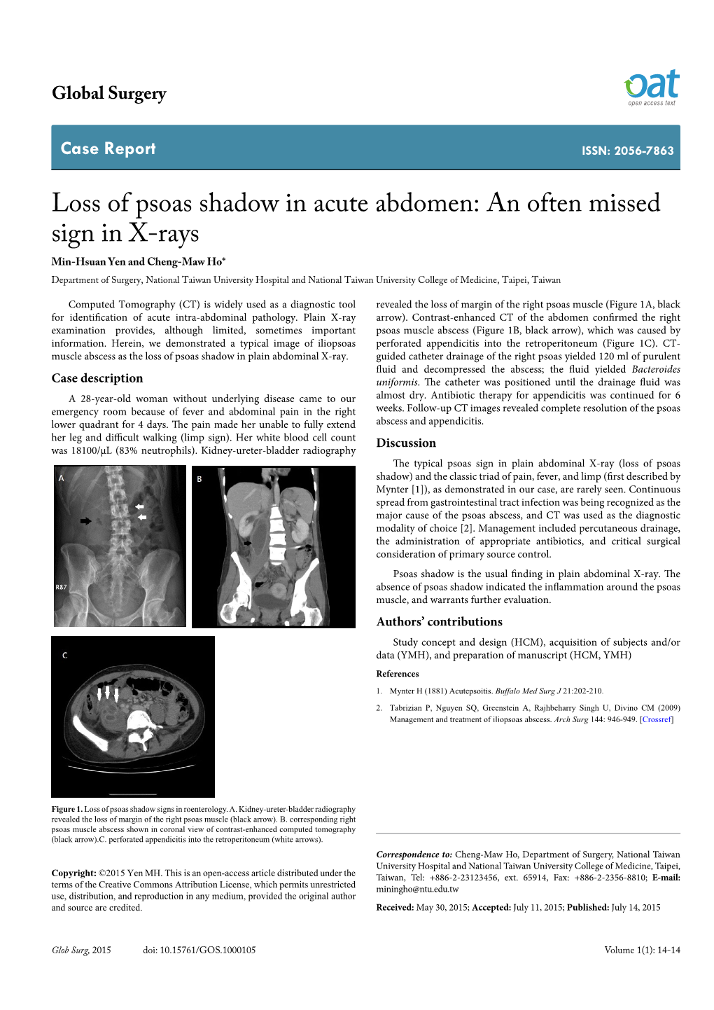 Loss of Psoas Shadow in Acute Abdomen