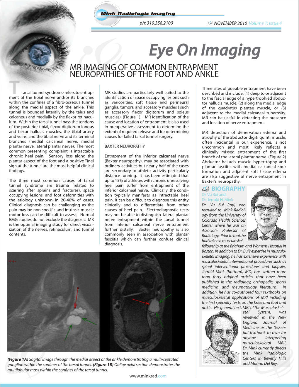 Entrapment Neuropathies of the Foot and Ankle