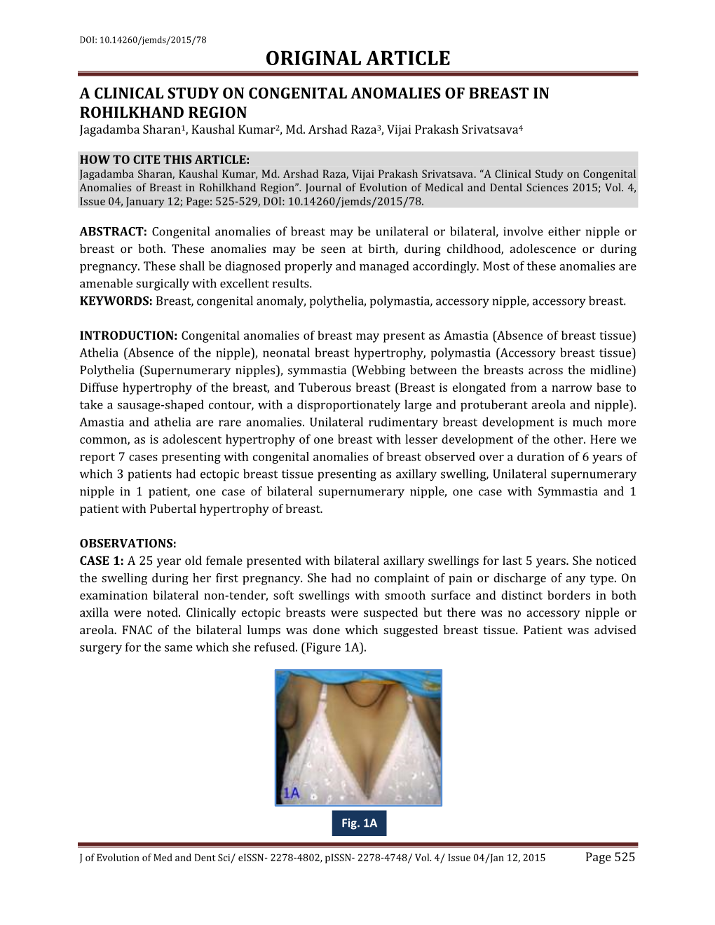 ORIGINAL ARTICLE a CLINICAL STUDY on CONGENITAL ANOMALIES of BREAST in ROHILKHAND REGION Jagadamba Sharan1, Kaushal Kumar2, Md