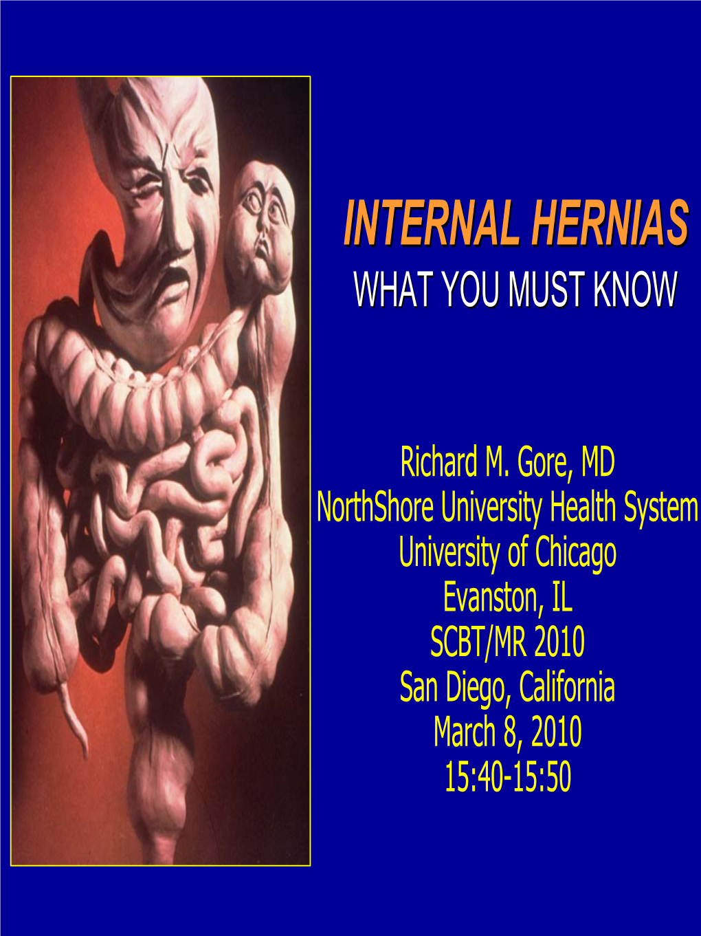 Internal Herniashernias Whatwhat Youyou Mustmust Knowknow