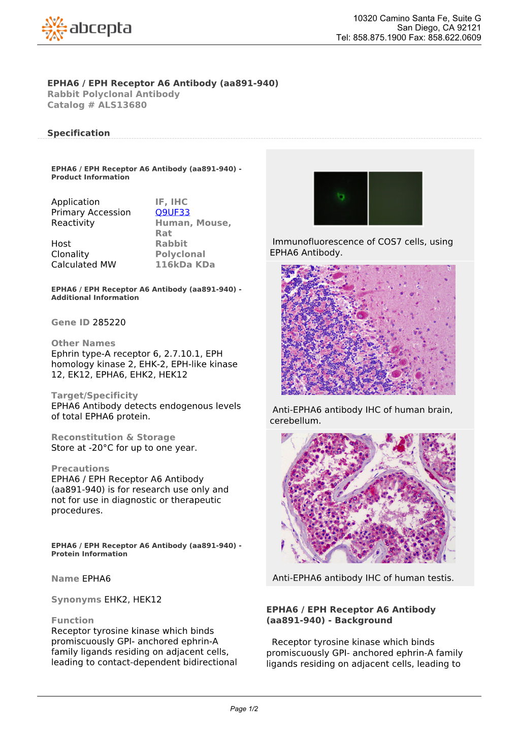 EPHA6 / EPH Receptor A6 Antibody (Aa891-940) Rabbit Polyclonal Antibody Catalog # ALS13680