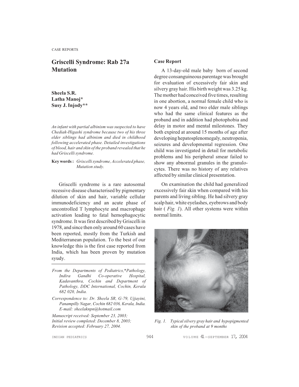 Griscelli Syndrome: Rab 27A Mutation