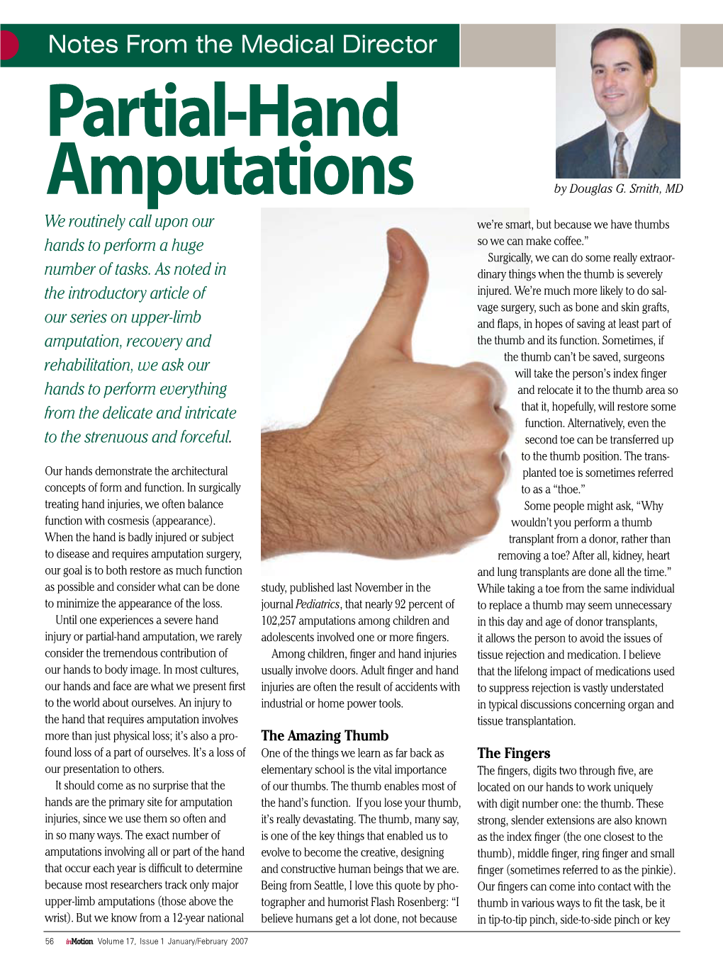 Partial-Hand Amputations by Douglas G
