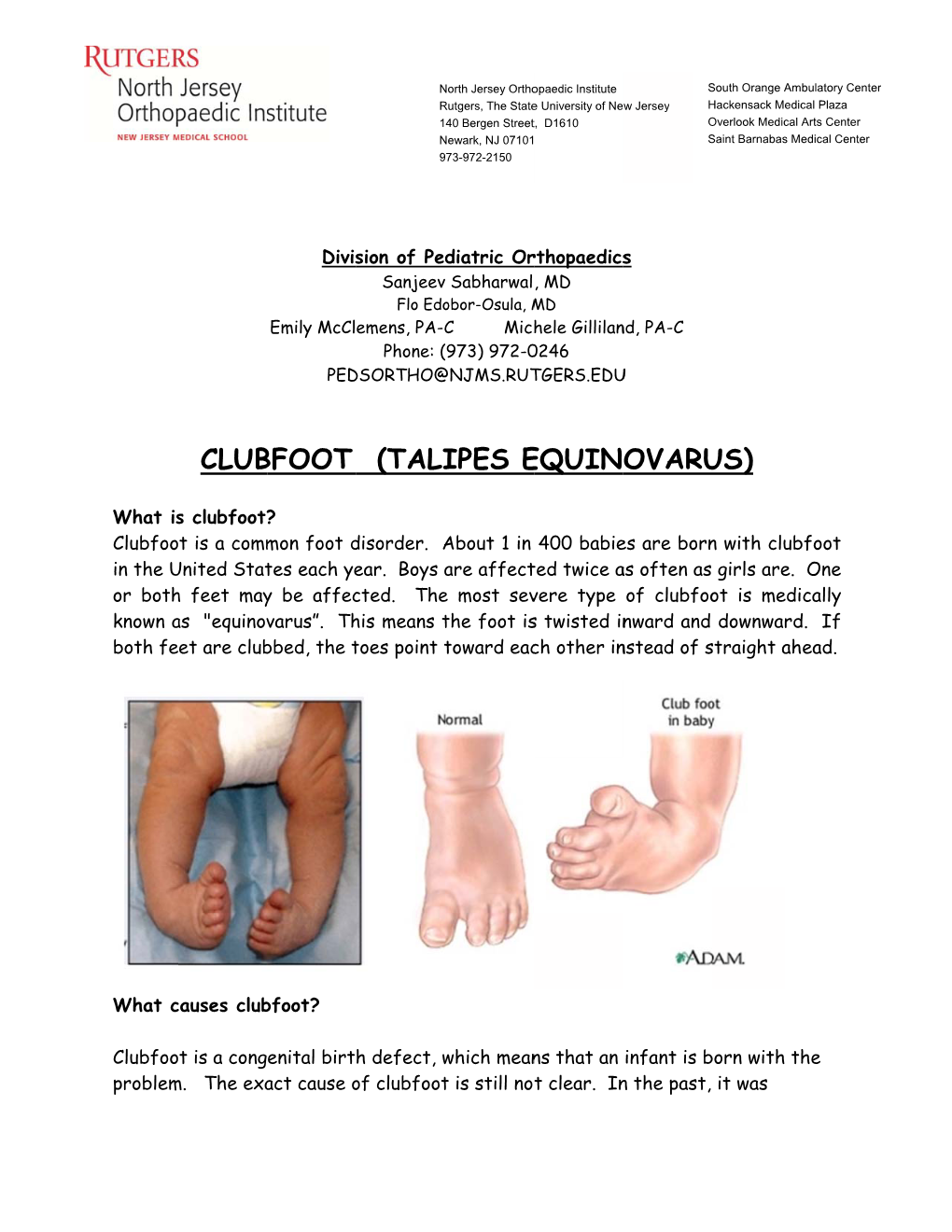 Clubfoot (Talipes Equinovarus)
