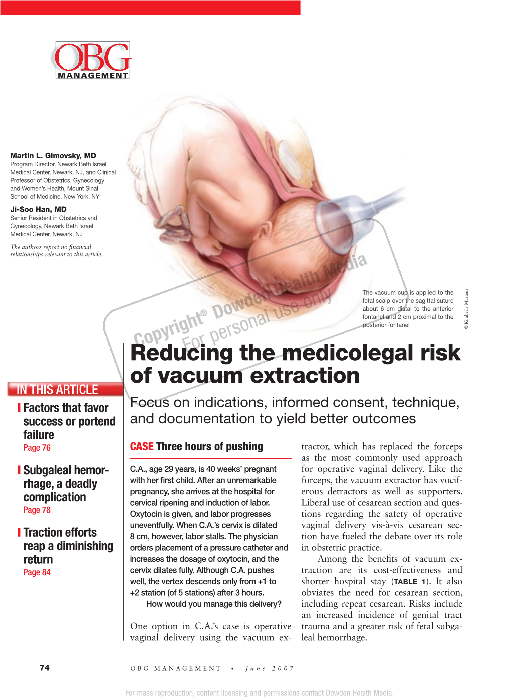 Reducing the Medicolegal Risk of Vacuum Extraction