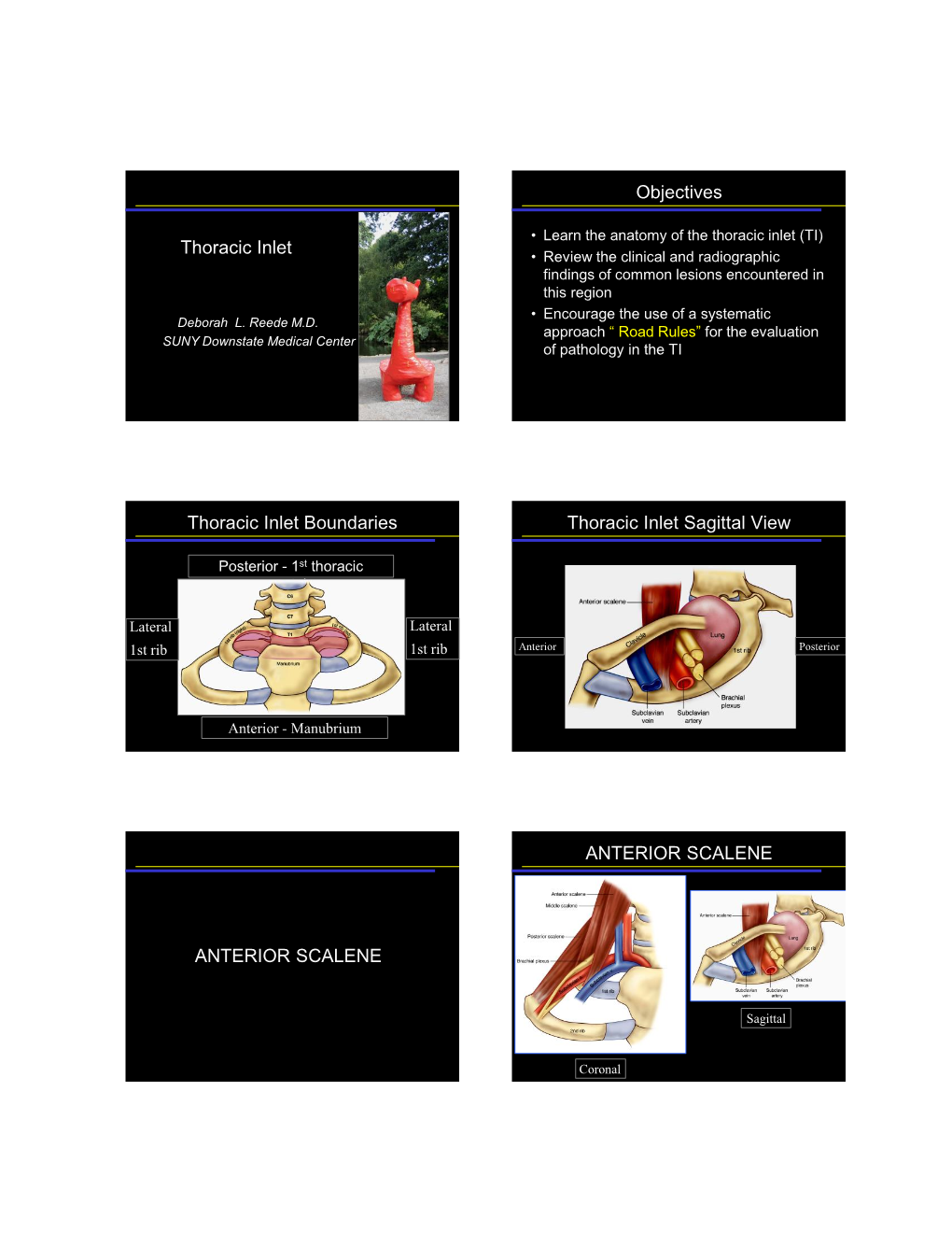 Thoracic Inlet Objectives Thoracic Inlet Boundaries Thoracic Inlet Sagittal