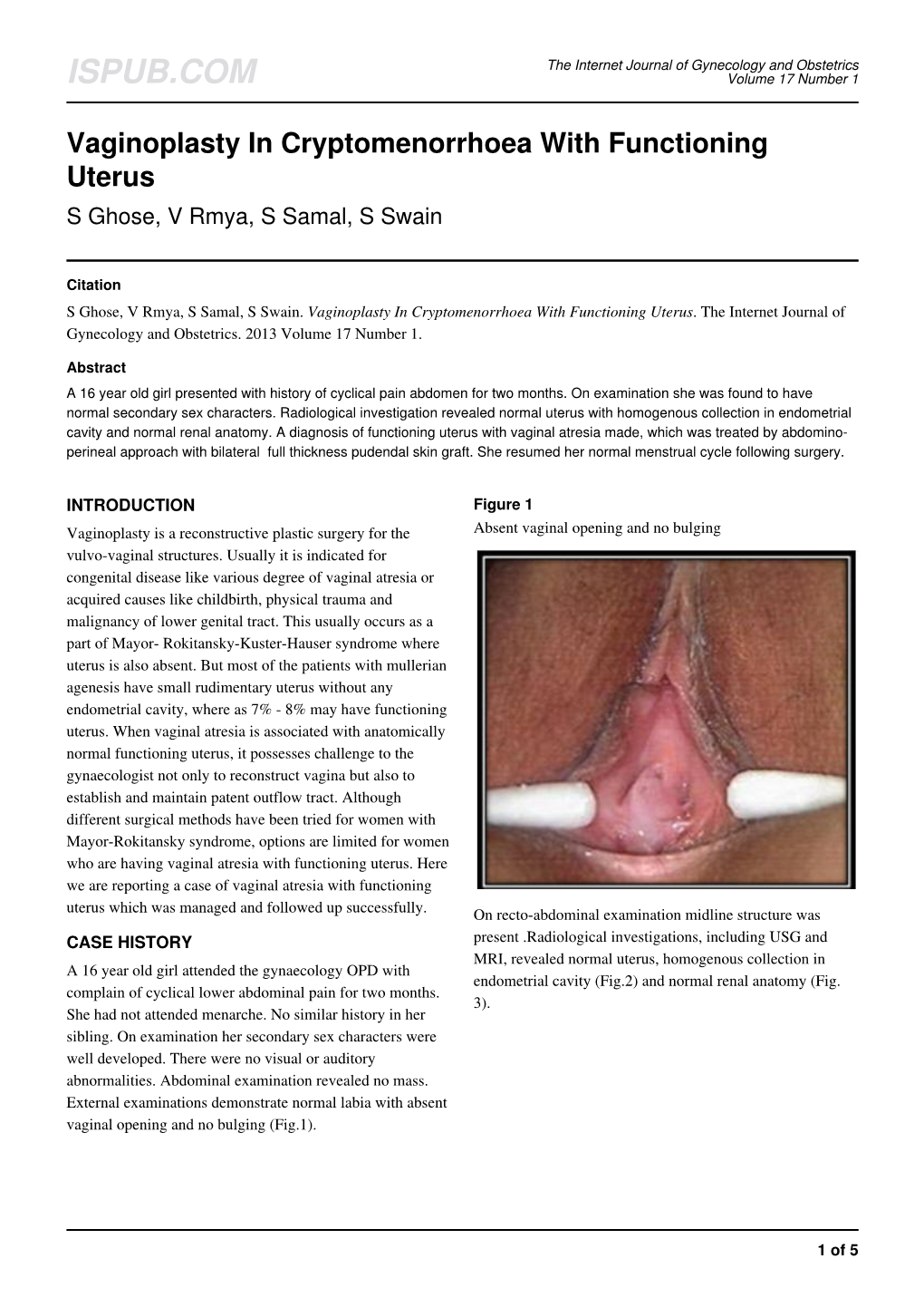 Vaginoplasty in Cryptomenorrhoea with Functioning Uterus S Ghose, V Rmya, S Samal, S Swain