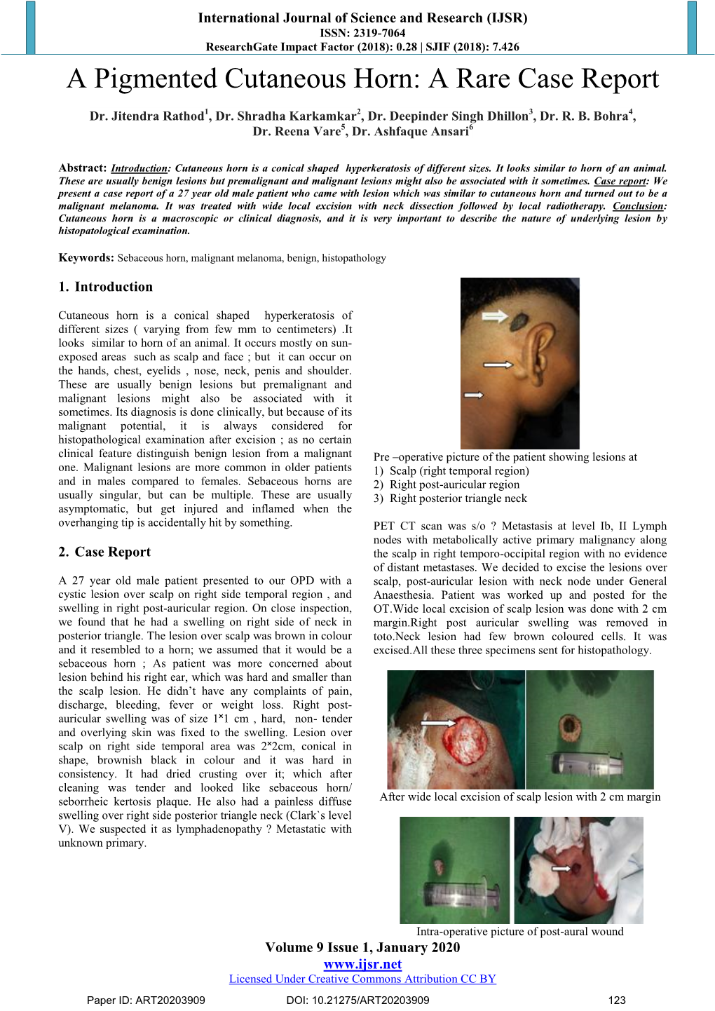 A Pigmented Cutaneous Horn: a Rare Case Report