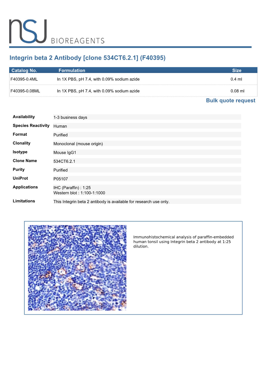 Integrin Beta 2 Antibody [Clone 534CT6.2.1] (F40395)