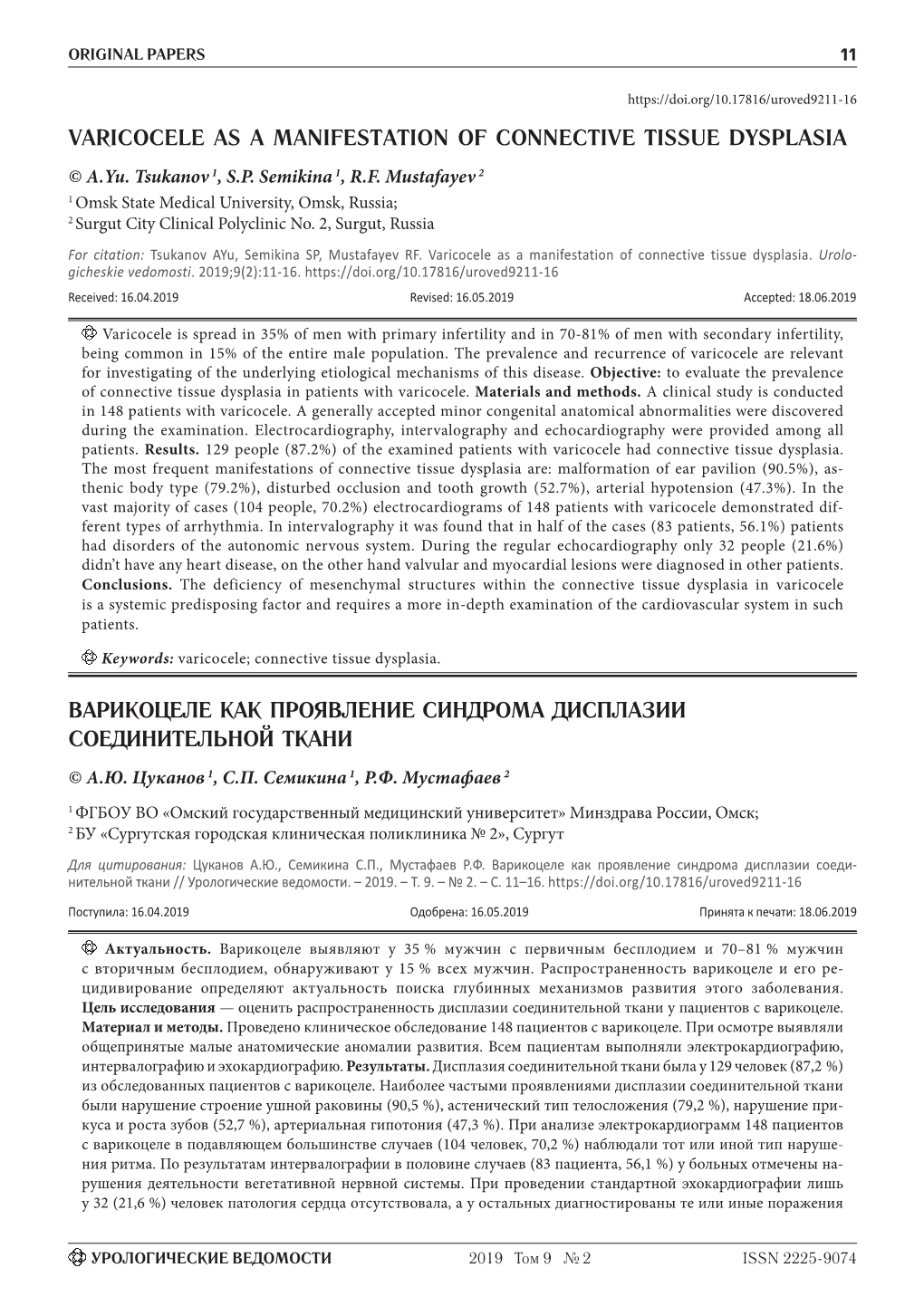 Varicocele As a Manifestation of Connective Tissue Dysplasia