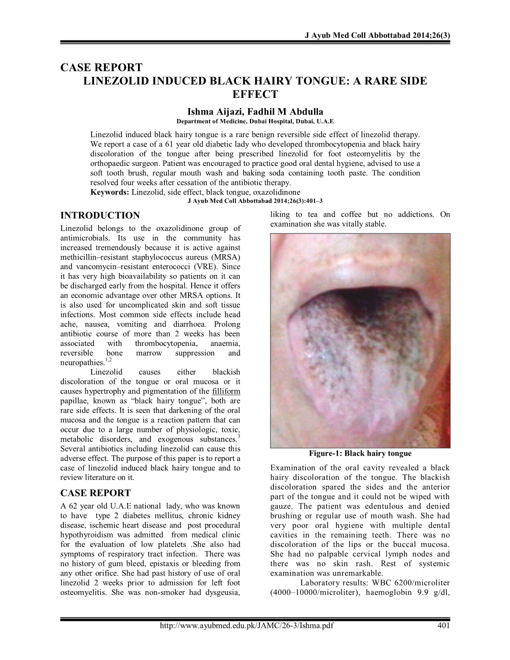 Linezolid Induced Black Hairy Tongue: a Rare Side Effect