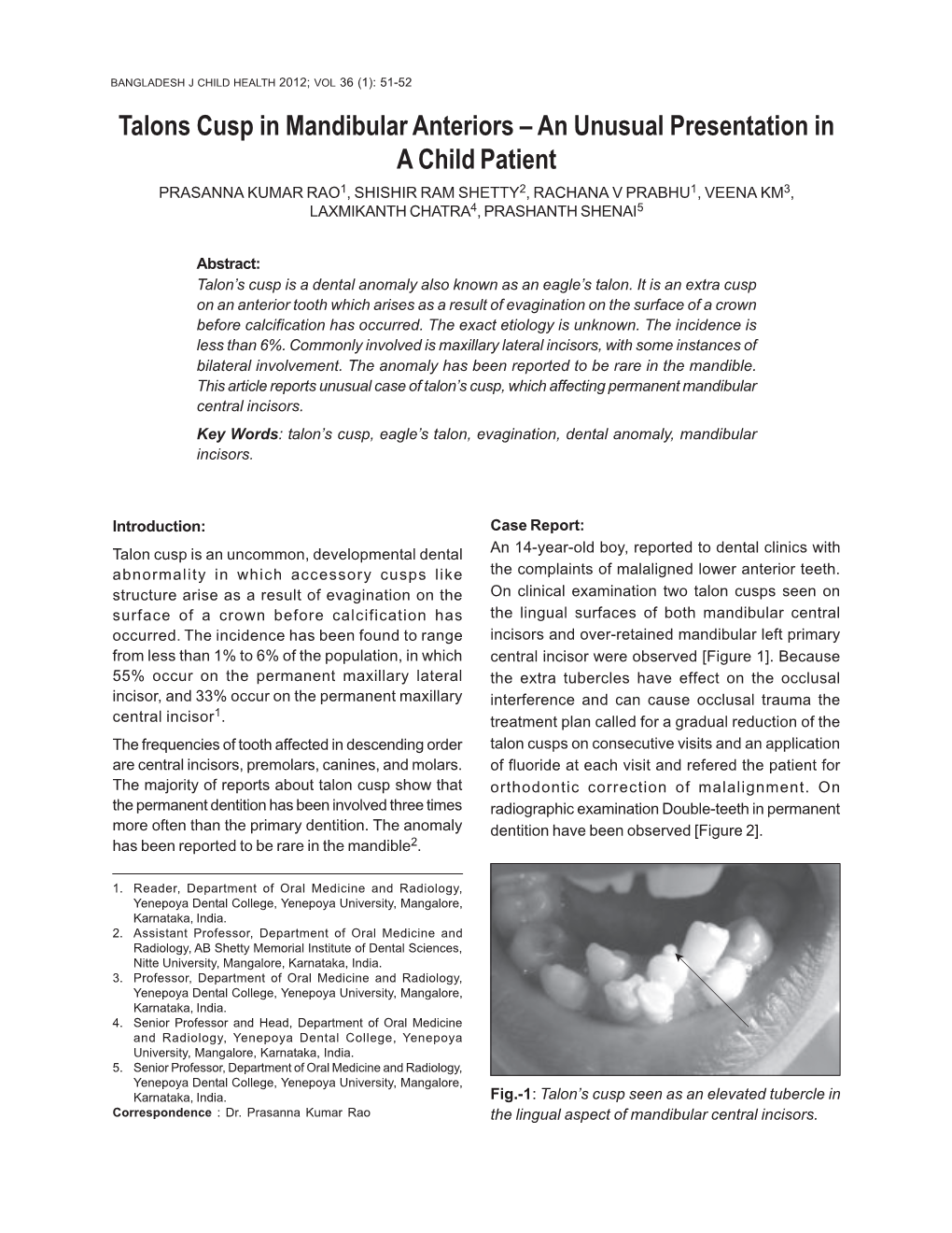 Talons Cusp in Mandibular Anteriors – an Unusual Presentation in A