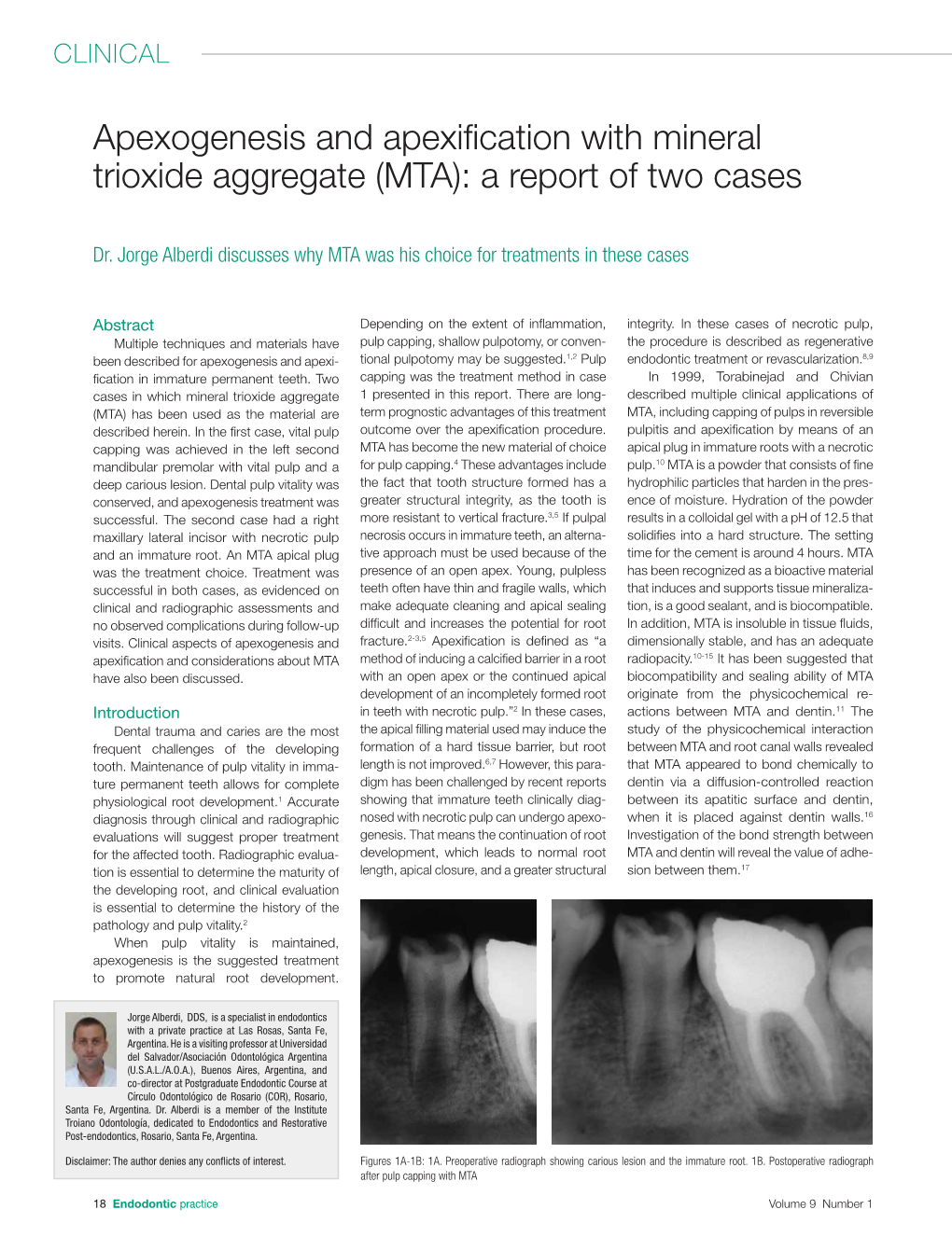Apexogenesis and Apexification with Mineral Trioxide Aggregate (MTA): a Report of Two Cases