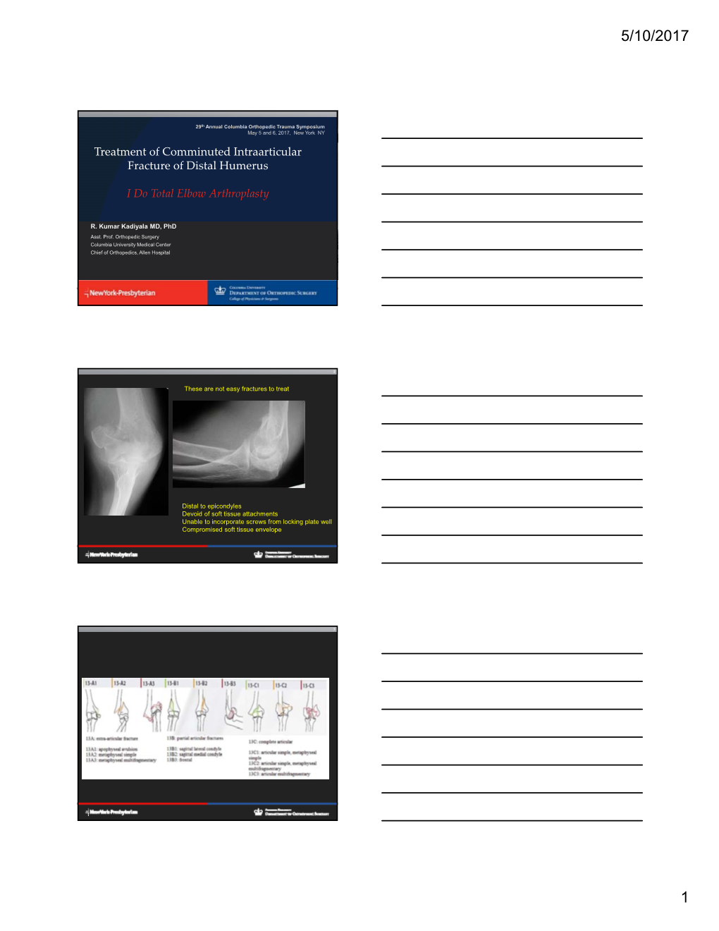 Treatment of Comminuted Intraarticular Fracture of Distal Humerus