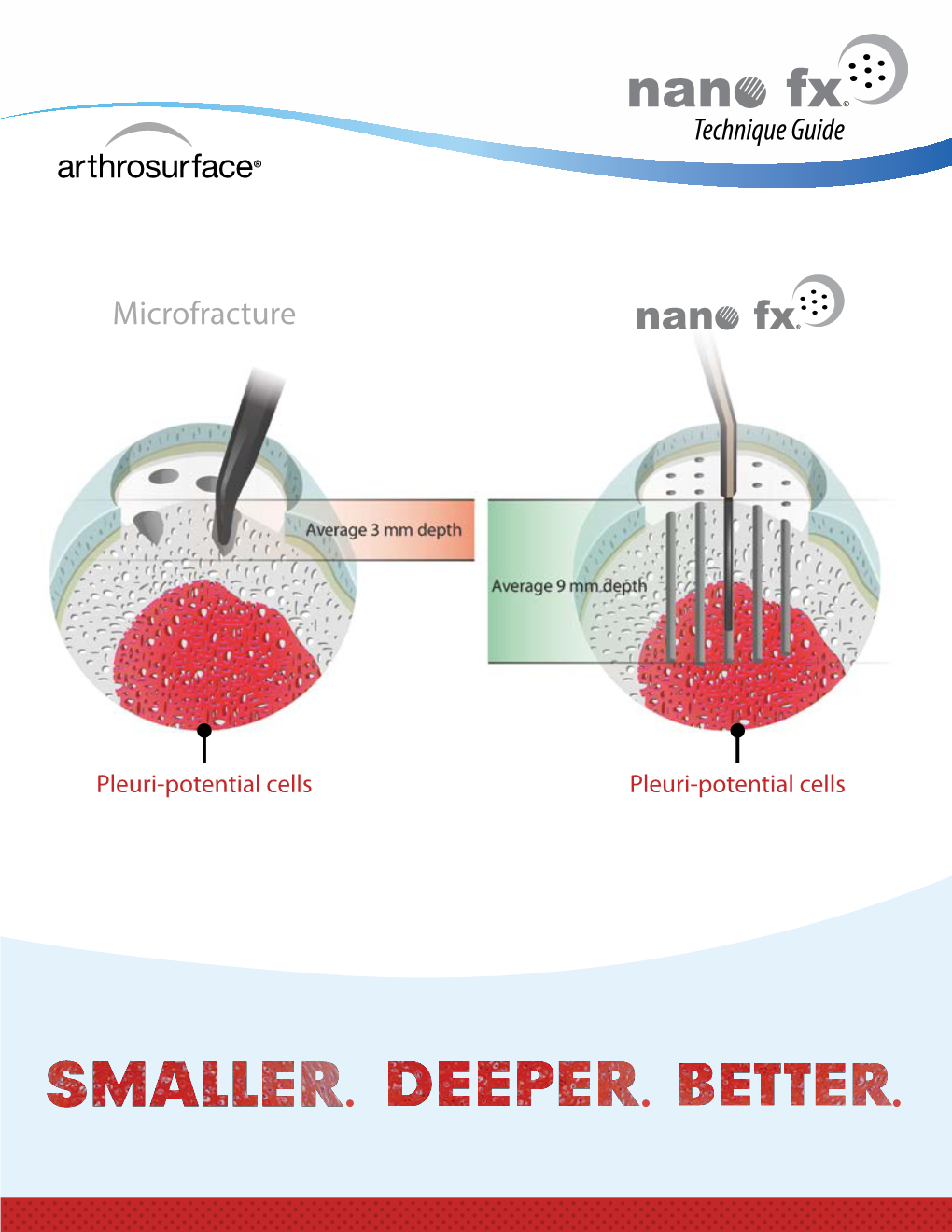 Microfracture