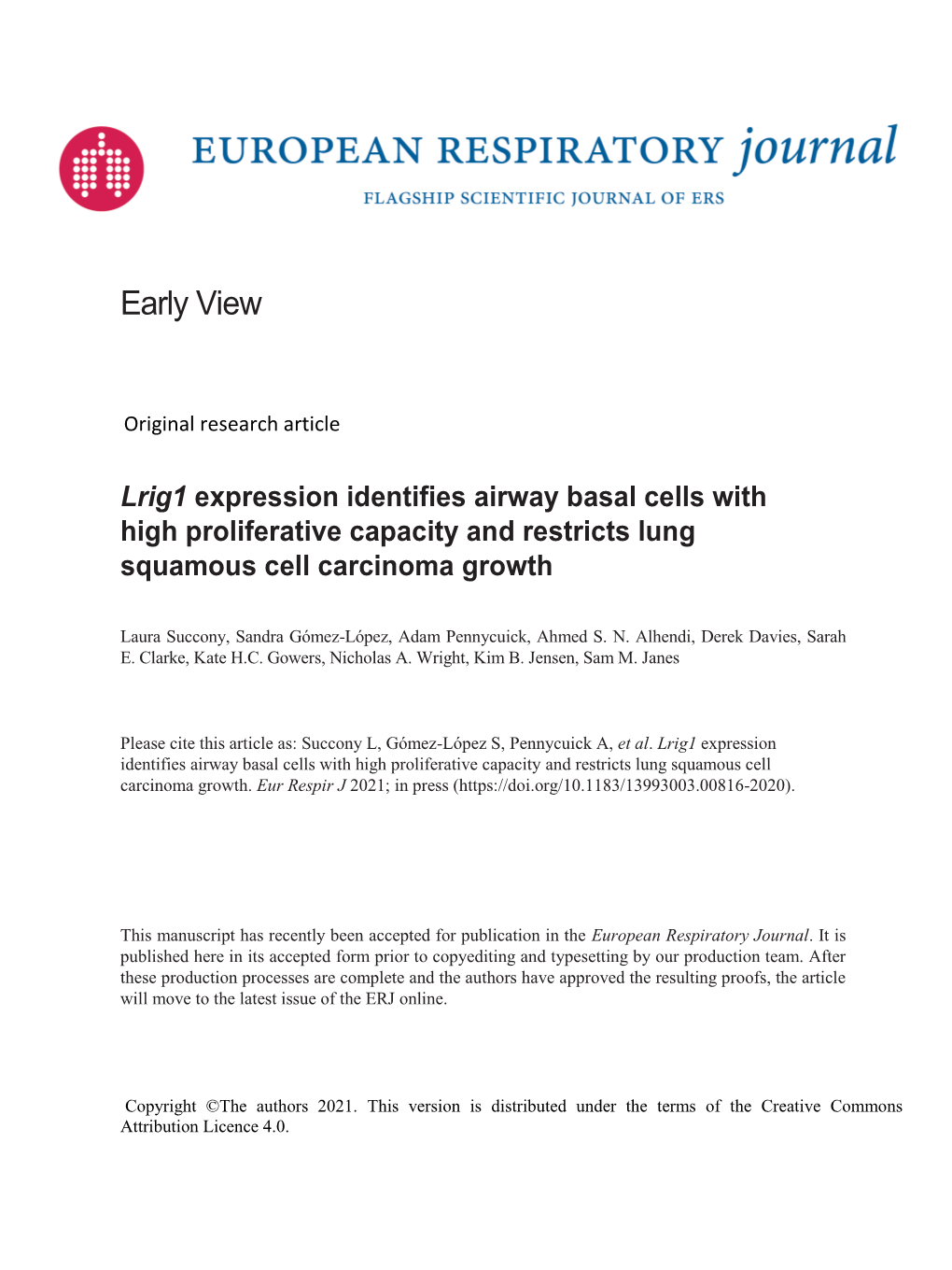 Lrig1 Expression Identifies Airway Basal Cells with High Proliferative Capacity and Restricts Lung Squamous Cell Carcinoma Growth