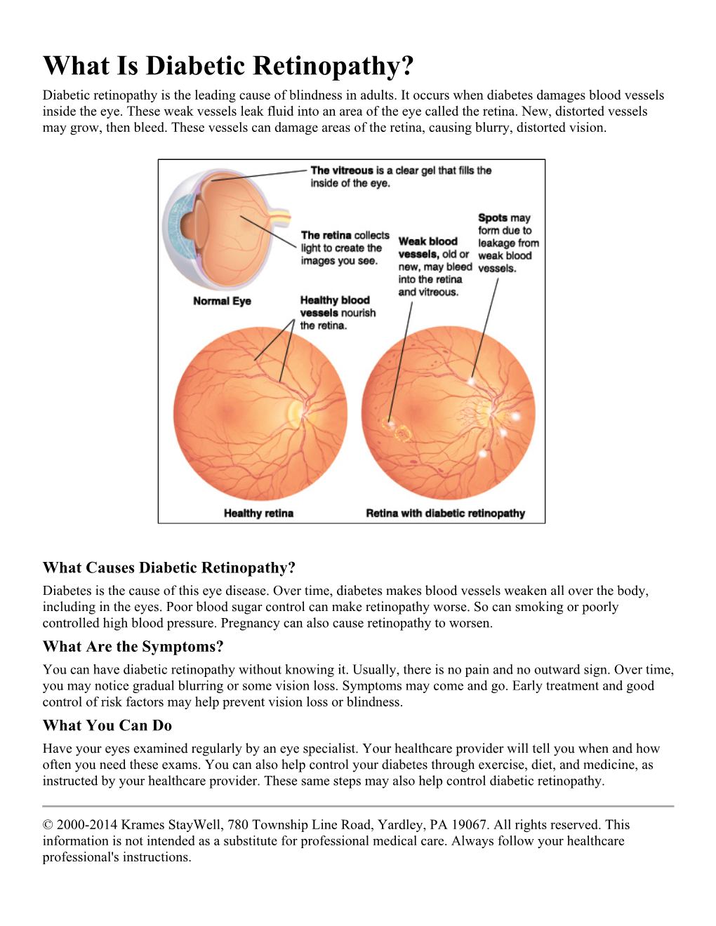 What Is Diabetic Retinopathy? Diabetic Retinopathy Is the Leading Cause of Blindness in Adults