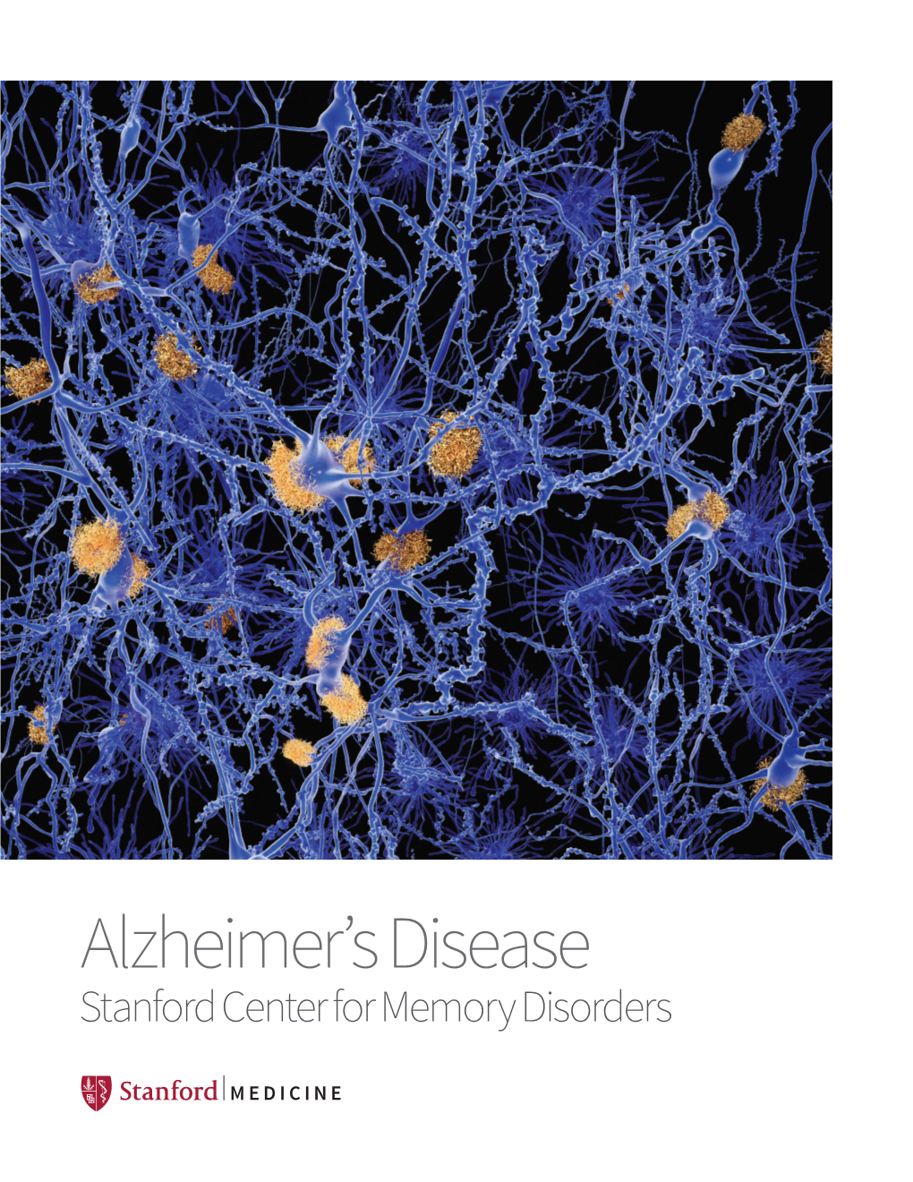 Alzheimer's Disease