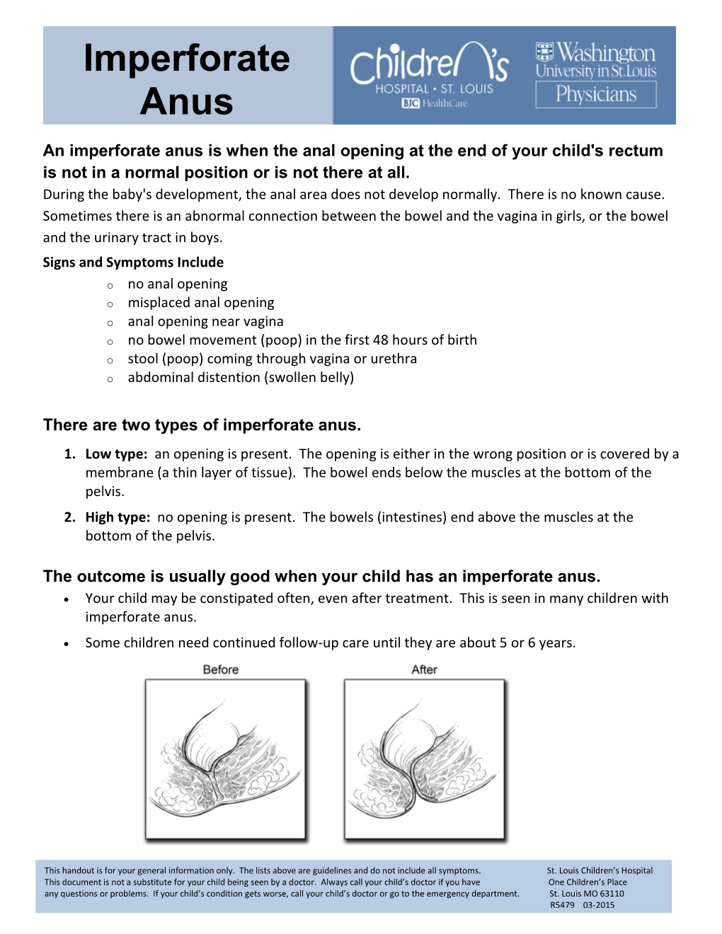 Imperforate Anus Is When the Anal Opening at the End of Your Child's Rectum Is Not in a Normal Position Or Is Not There at All