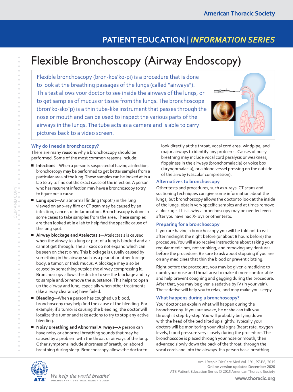 Flexible Bronchoscopy (Airway Endoscopy)