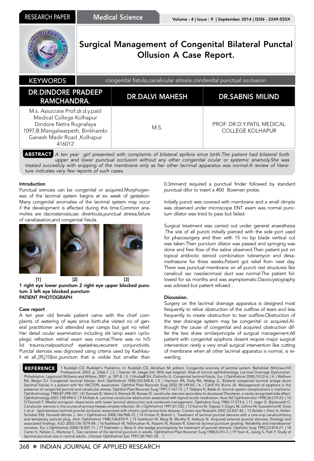 Surgical Management of Congenital Bilateral Punctal Ollusion a Case Report
