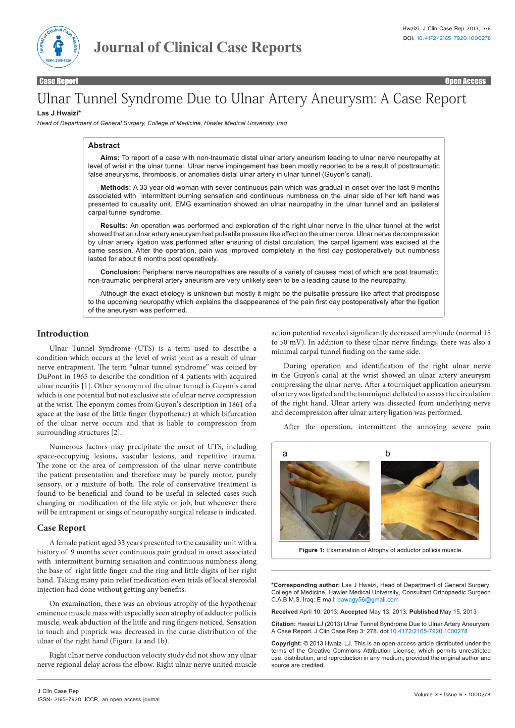 Ulnar Tunnel Syndrome Due to Ulnar Artery