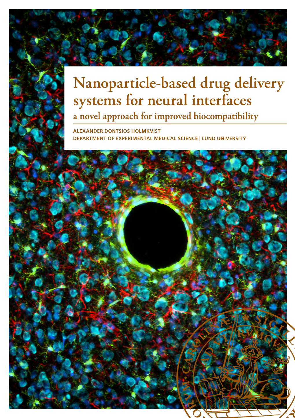 Nanoparticle-Based Drug Delivery Systems for Neural Interfaces 2020:120