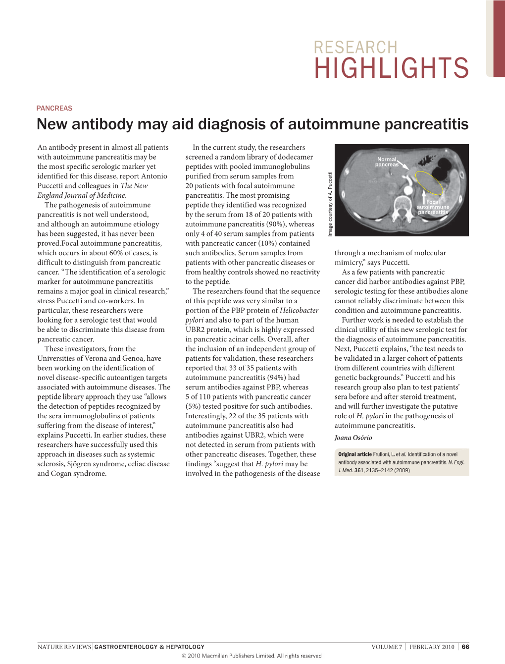 Pancreas New Antibody May Aid Diagnosis of Autoimmune Pancreatitis