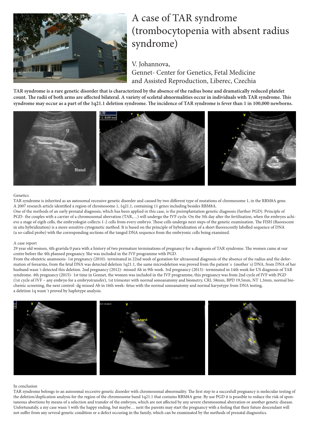 A Case of TAR Syndrome (Trombocytopenia with Absent Radius Syndrome)