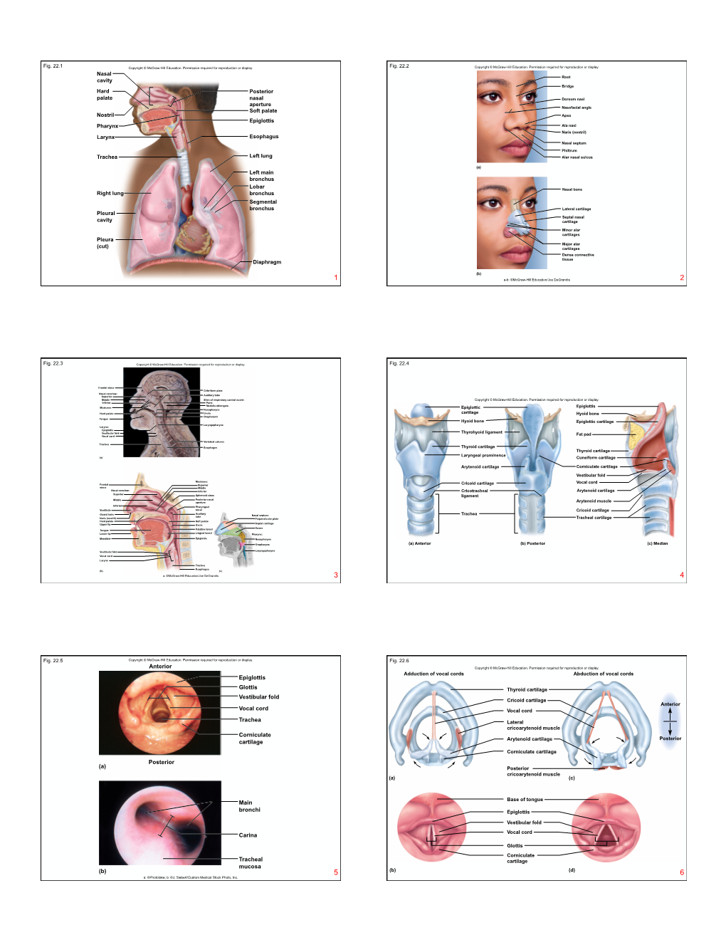 Epiglottis Anterior Glottis Vestibular Fold Vocal Cord Trachea Corniculate