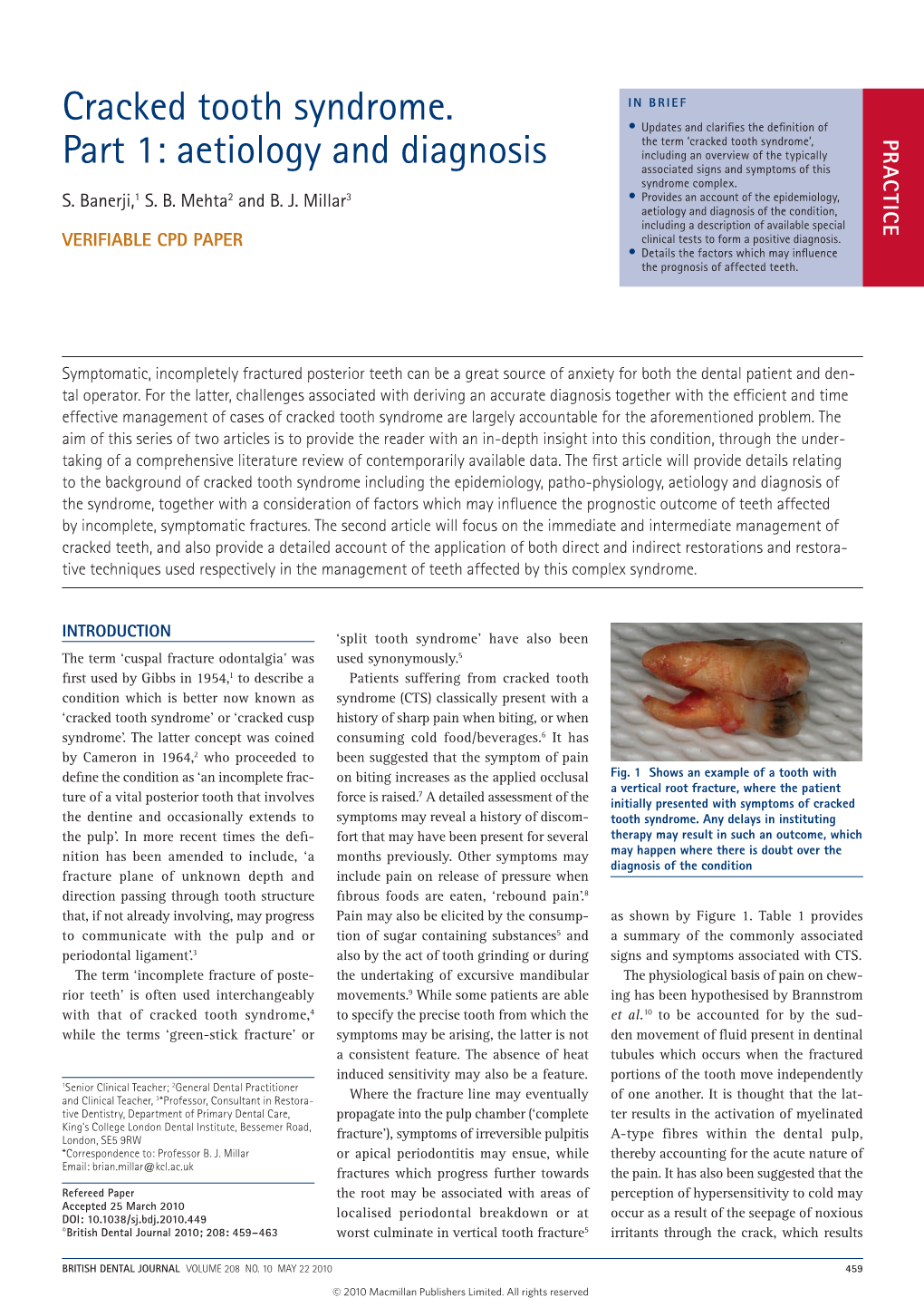 Cracked Tooth Syndrome. Part 1: Aetiology and Diagnosis