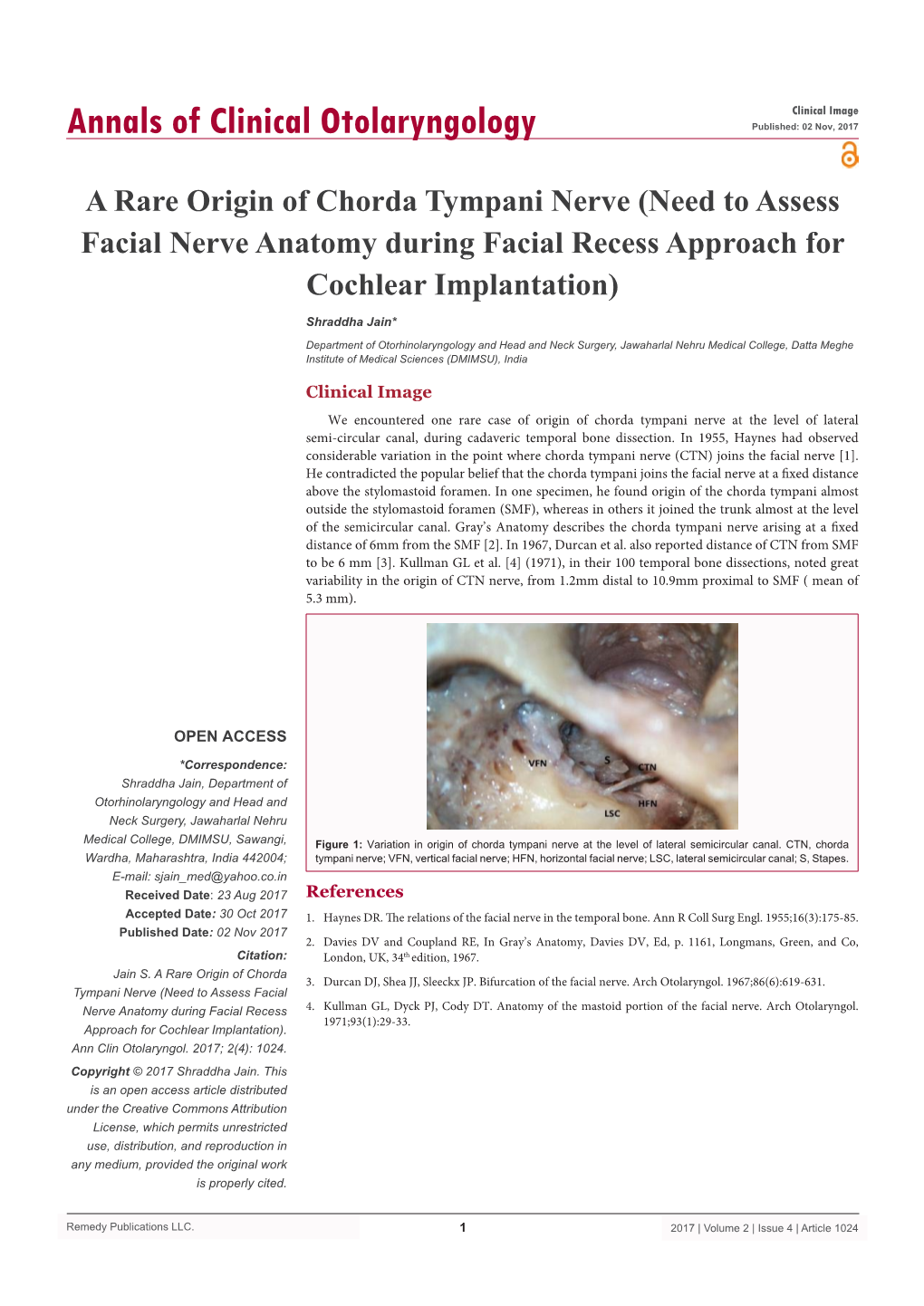 A Rare Origin of Chorda Tympani Nerve (Need to Assess Facial Nerve Anatomy During Facial Recess Approach for Cochlear Implantation)