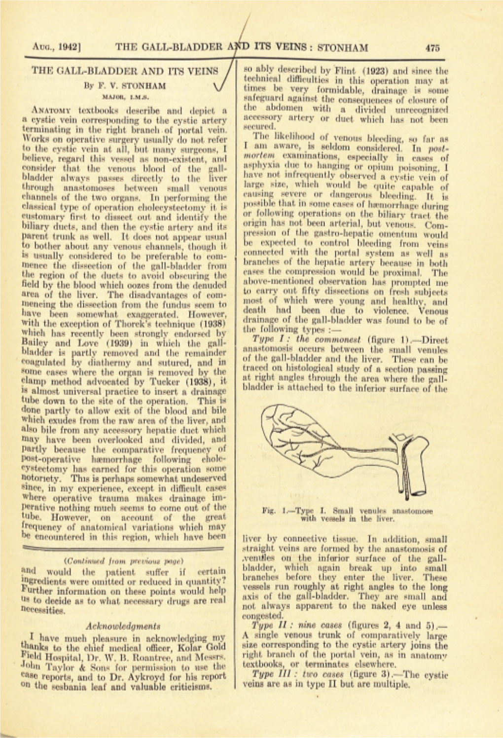 THE GALL-BLADDER and ITS VEINS So Ably Described by Flint (1923) and Since the Technical Difficulties in This May at by F